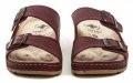 Medi Line S182-002 bordó dámske zdravotné nazúvaky | ARNO-obuv.sk - obuv s tradíciou